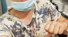 Superstarista skončil v nemocnici! Zrazil ho motocykel