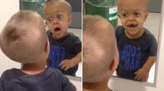 Chorý chlapec terčom posmechov. Hnusné komentáre ľudí zaboleli