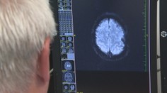 Na najzhubnejší nádor existuje v zahraničí drahá metóda. Poisťovne ju nechcú preplácať