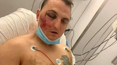 V Španielsku úraduje agresívny gang. Muža zhodil z útesu, keď s rodinou dovolenkoval