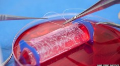 Zázrak modernej medicíny: Tínedžerkám implantovali „umelé" vagíny