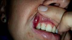 Peklo na slovenskej diaľnici! Mlátil ju pred malými deťmi a blokoval premávku