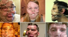 Nový hit na Facebooku. Ľudia si deformujú tvár lepiacou páskou