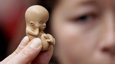 Jeden štát USA schválil najprísnejší zákon. Úplne zakazuje prerušenie tehotenstva