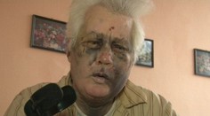 Zmlátili ďalšieho dôchodcu