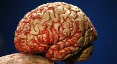 Nová štúdia poteší ženy: Ich mozgy sa oproti mužským zmenšujú pomalšie