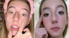 Narodila sa bez dôležitého svalu v tvári a tri roky nevedela žmurkať. Za jej výzor ju šikanovali v škole aj na pracovisku