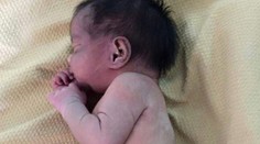 Chudiatko malé. Dieťa sa narodilo so ženskými aj mužskými genitáliami