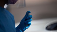 V nemocnici v Rimavskej Sobote potvrdili koronavírus zdravotnej sestre