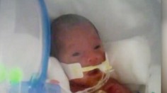 Hoci mala koronavírus, nebála sa ho. Napokon rodila v kóme o niekoľko týždňov skôr