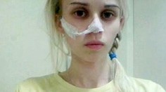 Sophie bojuje s anorexiou. Kalórie vraj aj dýcha