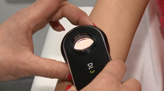 Pacienti majú novú nádej: Vedci priniesli prevratnú novinku pri liečení rakoviny kože