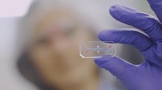 Budúcnosť medicíny? Inteligentné lieky menia prastaré liečebné metódy aj smrteľných ochorení