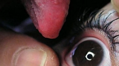 Babička tvrdí, že má zázračné sliny. Neuveríte, čo s nimi lieči