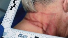 Aby prežila, vyskočila z balkóna. Dôchodkyňa prežila útok a škrtenie vlastnou dcérou