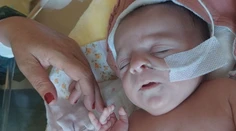 Siamské dvojčatá presunuli z Bratislavy. Lekári prezradili, ako sa dievčatám darí
