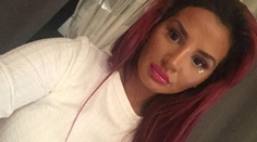 Zuzana Plačková radikálne zmenila imidž. Nový nos aj vlasy