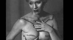 Herečka zverejnila svoj boj. Snímky pred a po odstránení prsníkov