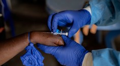 Nový variant opičích kiahní sa prvýkrát preniesol medzi ľuďmi v Európe