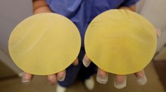 Súd rozhodol v kauze nekvalitných prsných implantátov, desiatky tisíc žien sa dočkajú odškodného