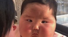 Žena zostala v šoku, keď sa dcére nafúkla tvár a začali jej na nej rásť vlasy. Za všetko môže krém