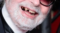 Hviezda šokovala fanúšikov. Otvoril ústa a zuby nikde