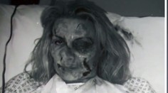 Tvár jej znetvoril manžel, dnes je chodiacou reklamou na plastiku