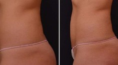 Takéto ploché bruško môžete mať už za mesiac!