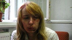 Nový posudok: Hedviga klamala