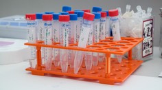 Na Slovensku stále dominuje britská mutácia, celkovo odhalili 35 prípadov delty