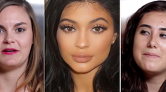 Nechali si napichať pery, aby boli ako Kylie Jenner. Ako dopadli?