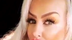 Exfarmárka má pery až po nos. Ani Kucherenko sa na ňu nechytá