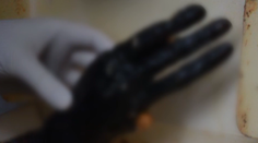 Expertíza odhalila nové skutočnosti o ruke objavenej v útrobách banskobystrického činžiaku