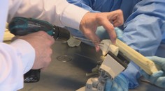 Lekári pri zlomeninách čoraz viac používajú neviditeľné skrutky. Tie zmiznú bez ďalšej operácie