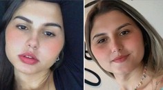 Prvé na svete. Brazílske dvojičky podstúpili simultánnu zmenu pohlavia