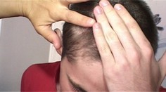 Agresivita na základnej škole v Tornali. Žiaka vraj zbil SBS-kár