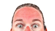 Pozor na zákerné slnko. Môže spôsobiť mnoho ťažkostí