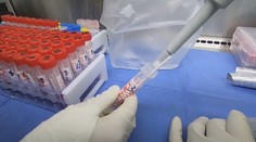 Nový kmeň vtáčej chrípky má prvú ľudskú obeť. Zisťovali sme, či sa máme niečoho obávať