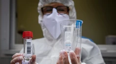 Na Slovensku pribudlo 474 prípadov nákazy koronavírusom a štyri obete
