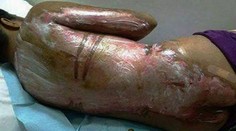 Nepriniesla kávu dostatočne rýchlo, jej pani ju za trest obarila vriacou vodou