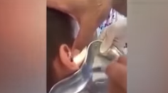 Chlapca trápila bolesť ucha. Doktor si musel poradiť s larvami