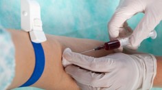 Kto vám v nemocnici zoberie krv alebo podá liek? Minister pripravuje zmenu