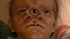 Trpeli a zarábali. V Nitre si môžete pozrieť figuríny ľudí s chorobami