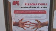 Žltačka na juhu Slovenska nepoľavuje. Hygienici museli rázne zasiahnuť, jeden z prípadov preveruje aj polícia
