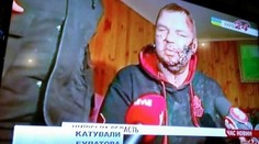 Hrôza z protestov v Kyjeve! Vodcovi aktivistov odrezali ucho a ukrižovali ho