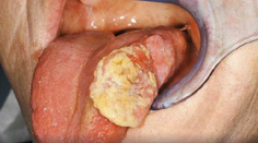 Tieto obrázky už čoskoro na škatuľkách: Po pozretí si cigaretu tak skoro nezapálite!