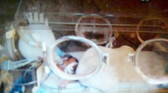 Mesačné dieťa vyhlásili za mŕtve. Pred kremáciou prišiel šok