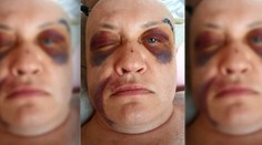 Mariána mal vraj takto doriadiť policajt v sanitke