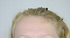 Polícia už vie, komu patrili ostatky pri Botanickej záhrade