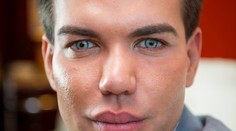 Muž posadnutý plastikami. Už vyzerá ako Ken